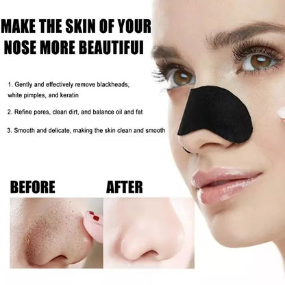 Nose Pore Strips