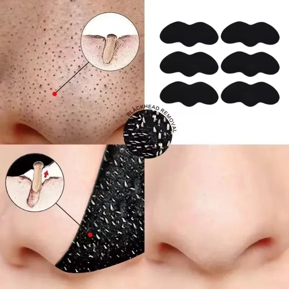 Nose Pore Strips